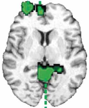 IRM soon et al