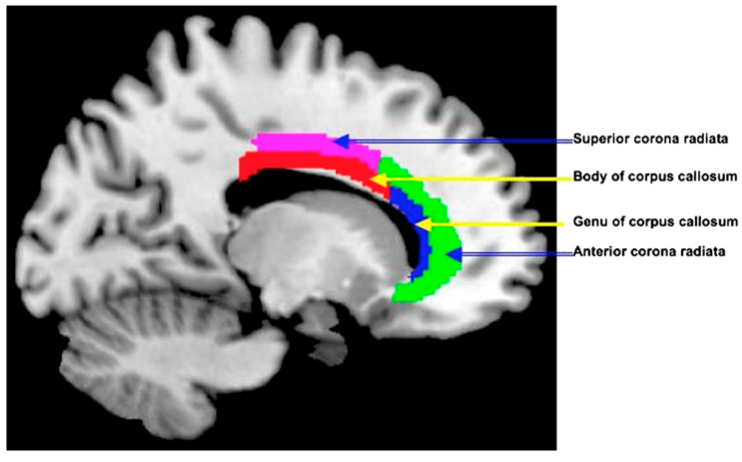 méditation cerveau